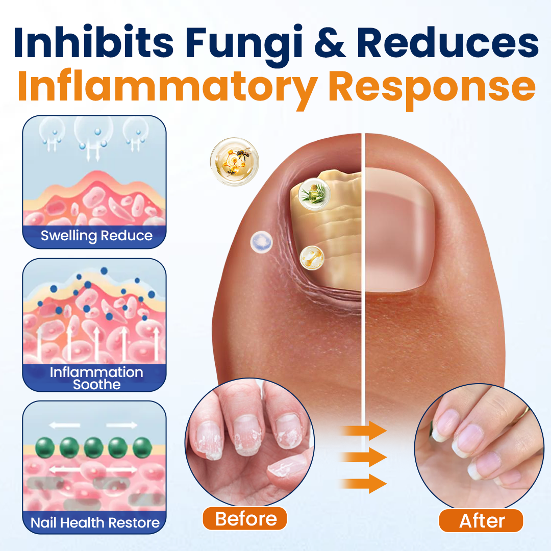 Supplied nail and inflammation illustration