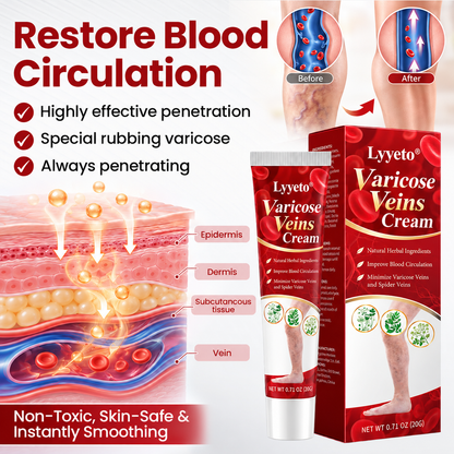 Lyyeto® Varicose Veins Cream – Daily Leg Care & Skin Comfort, 20g