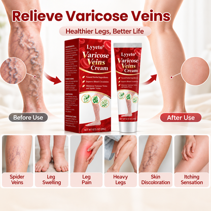 Lyyeto® Varicose Veins Cream – Daily Leg Care & Skin Comfort, 20g