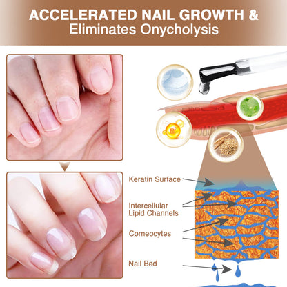 💜Kisshi™ OnycholysisHeal Nail Strengthening And Growth Conditioner