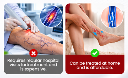 Lyyeto® Varicose Veins Cream – Daily Leg Care & Skin Comfort, 20g
