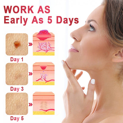 ✨KISSHI™ WipeOffEase Tags & Moles Remover ✨