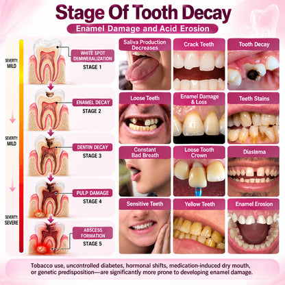 LUHAKA® DenPerm Cavity-Repair Gel