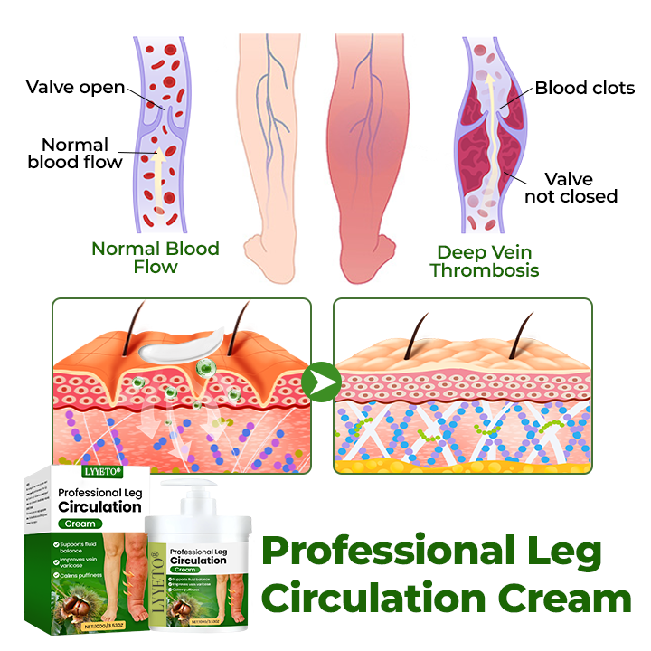 Lyyeto® Botanical Leg Care Cream — Daily Skin Comfort & Moisture, 100g
