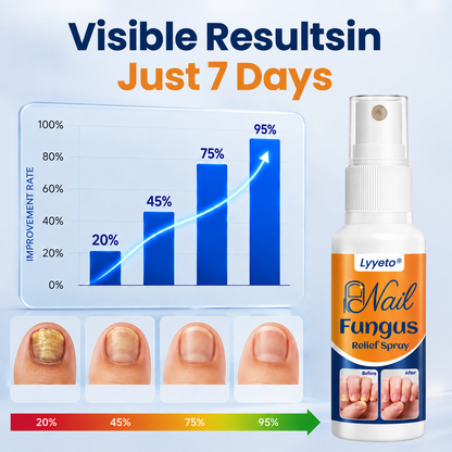 Lyyeto® Nail Care Spray – Targeted Nail & Cuticle Care, 30ml