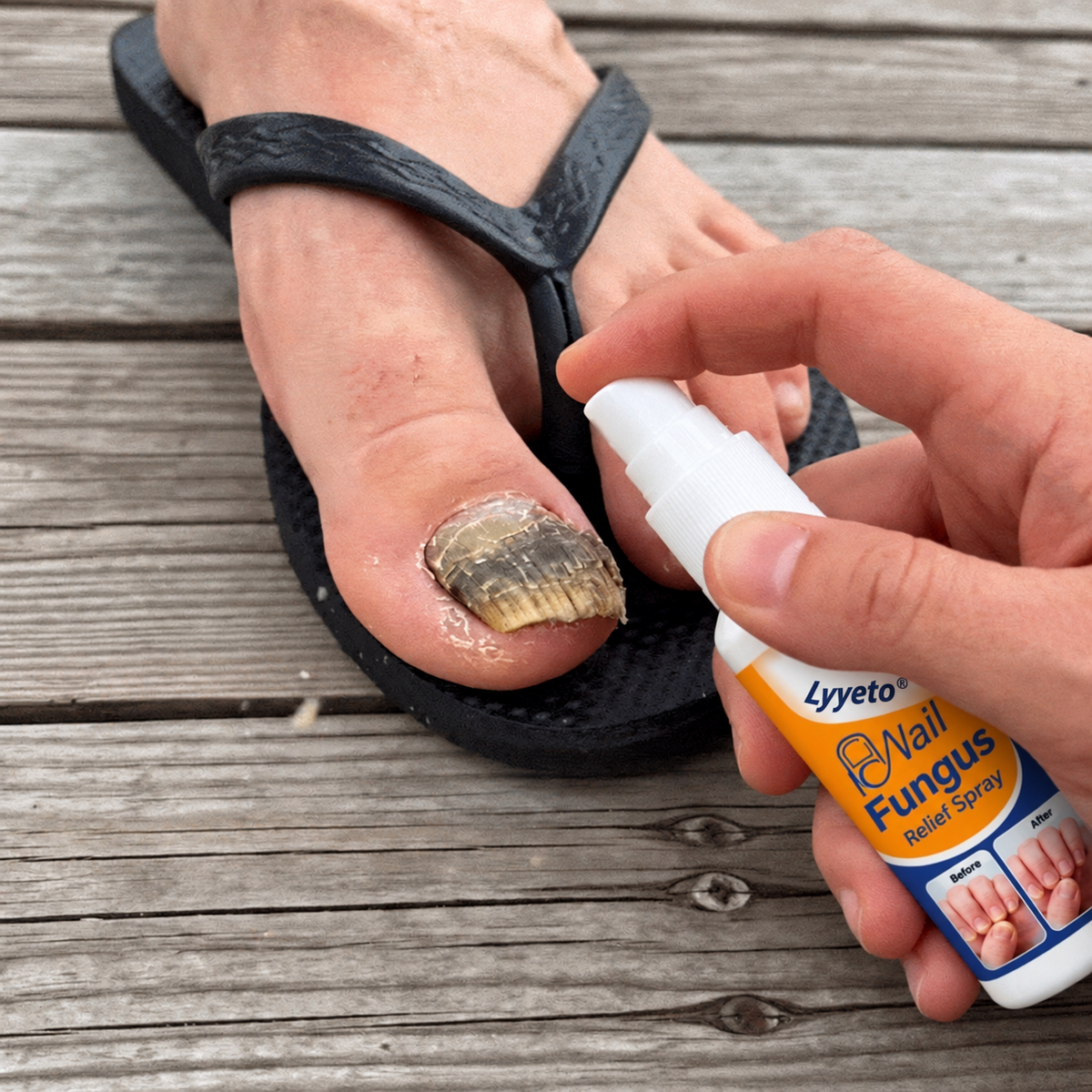Lyyeto® Nail Care Spray – Targeted Nail & Cuticle Care, 30ml
