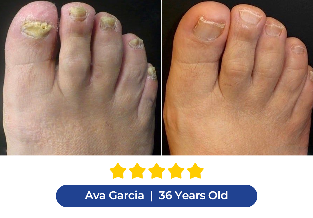 Supplied nail appearance comparison with named testimonial