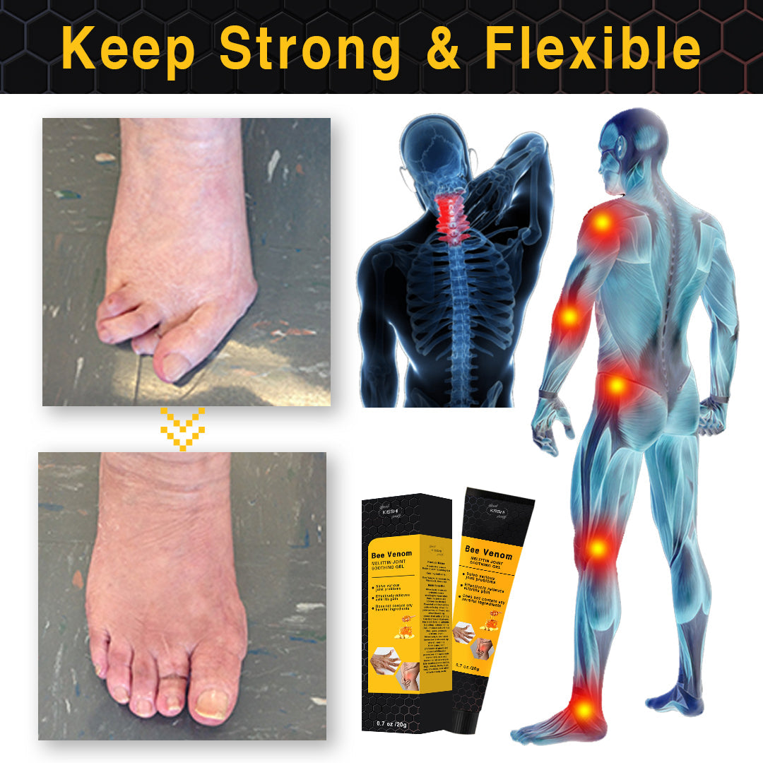 Kisshi™ Bee Venom Melittin Joint Soothing Gel