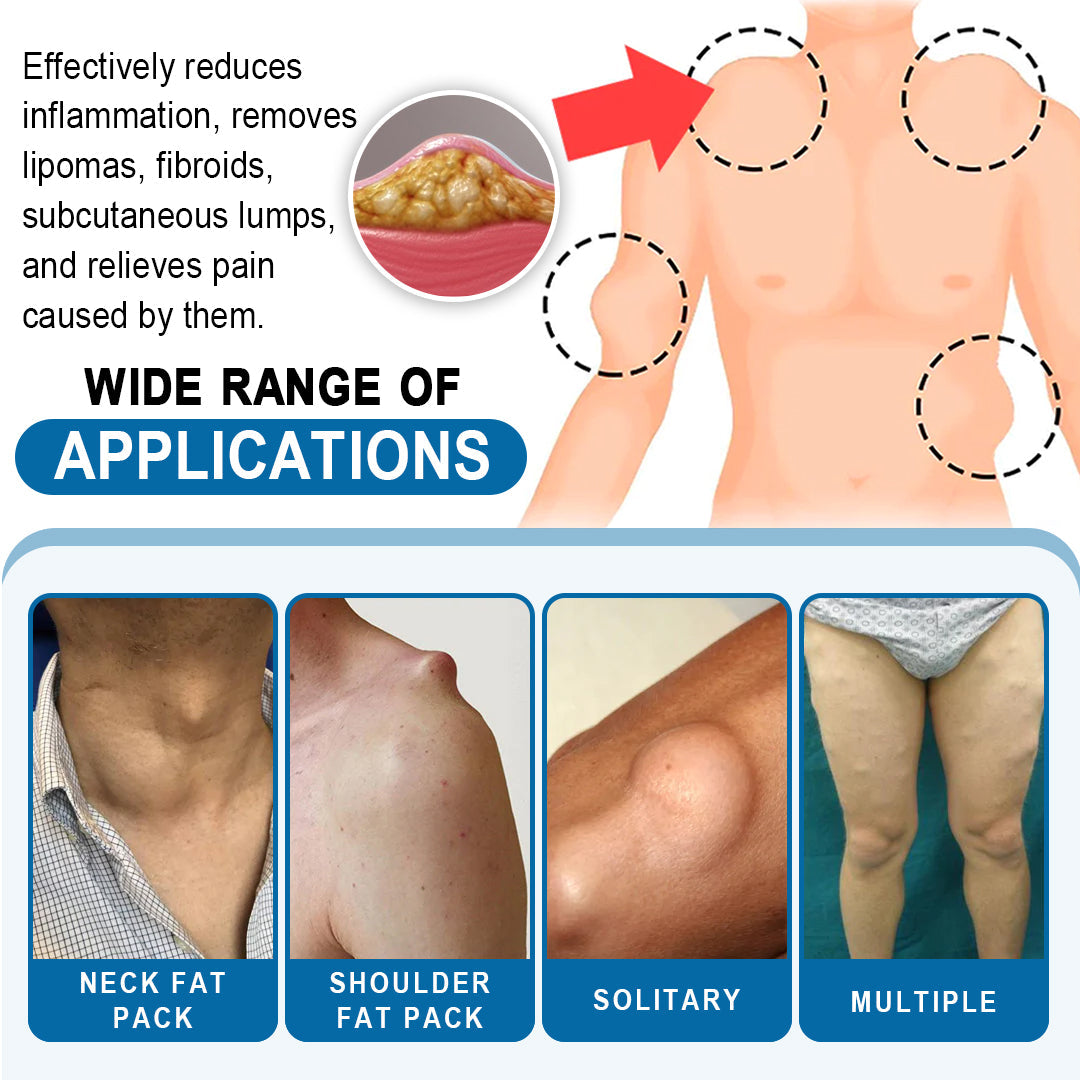 🔥Enjoy Discounts💛KISSHI™ Lipoma Removal Cream