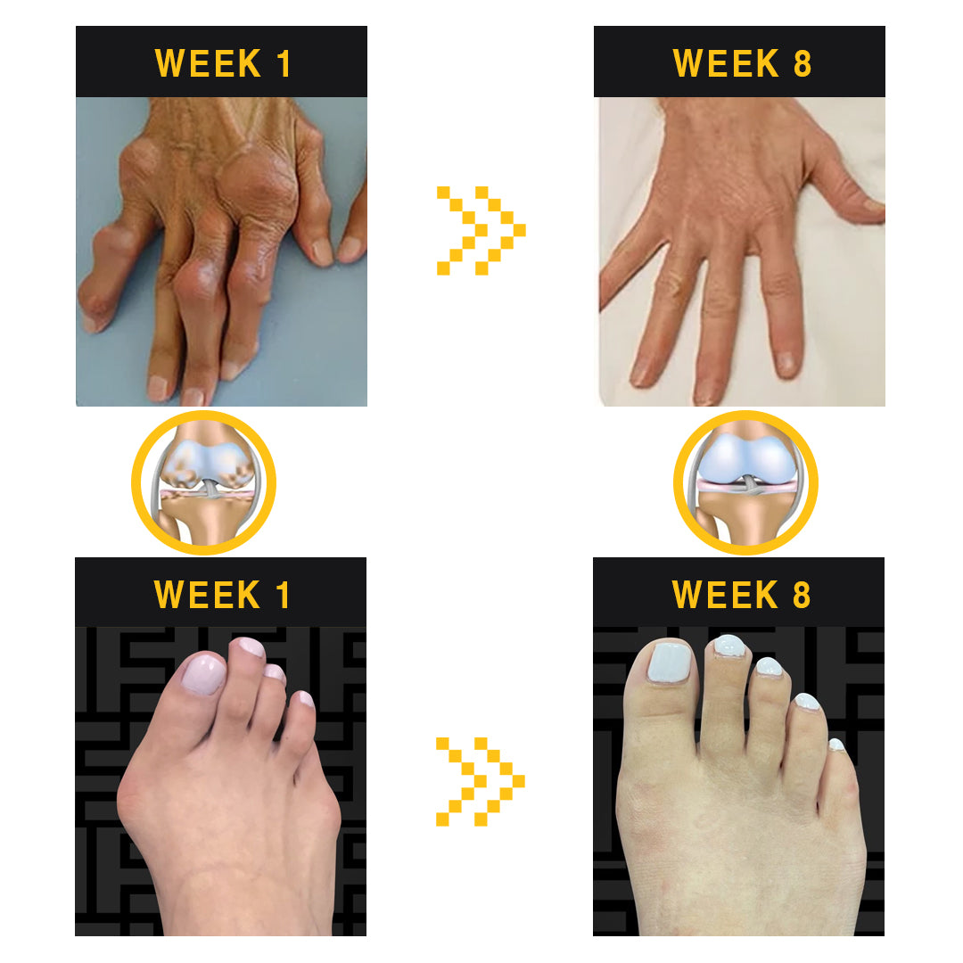 Kisshi™ Bee Venom Melittin Joint Soothing Gel