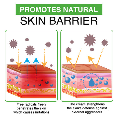 Kisshi™ Seborrheic Dermatitis Cream