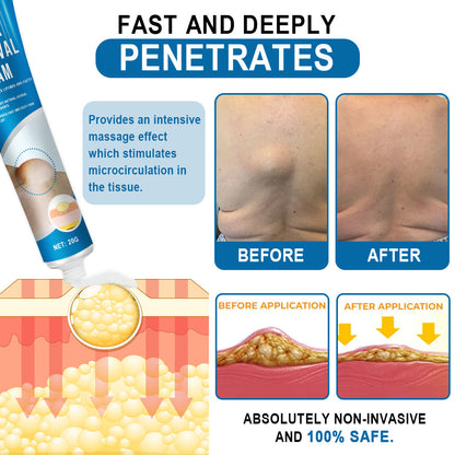 🔥Enjoy Discounts💛KISSHI™ Lipoma Removal Cream