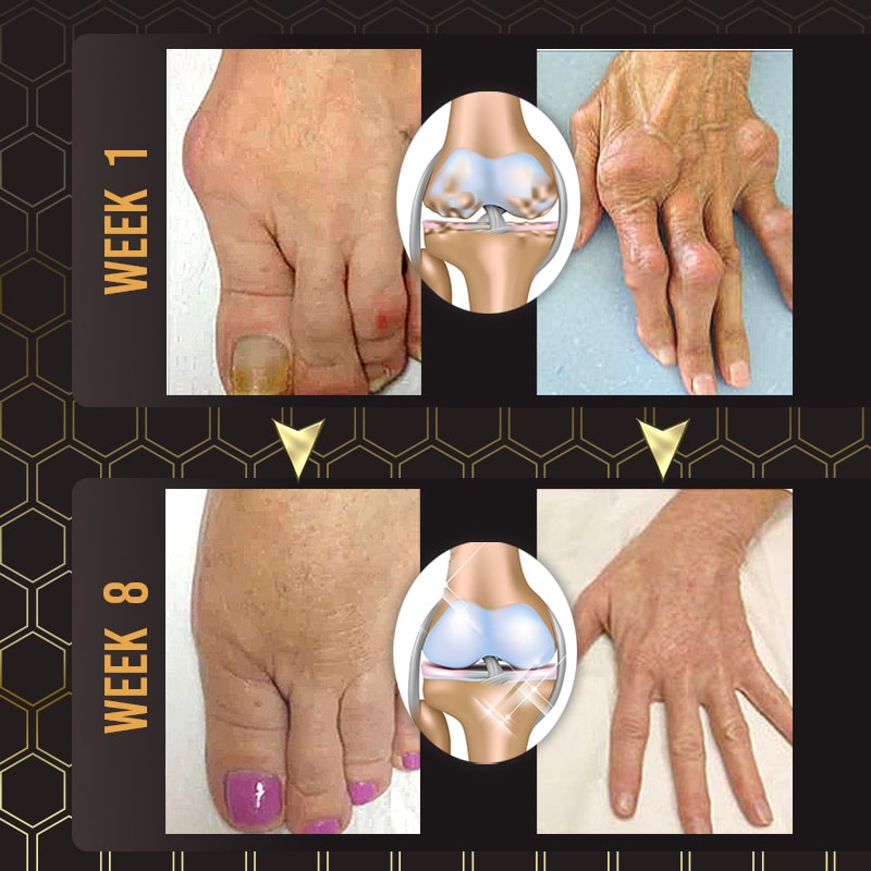 Joint Soothe™ Bee Venom Joint Relief Gel