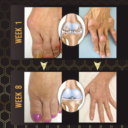 Joint Soothe™ Bee Venom Joint Relief Gel