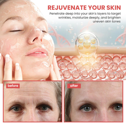 ✨KISSHI™ Advanced Matrixyl 3000 Serum